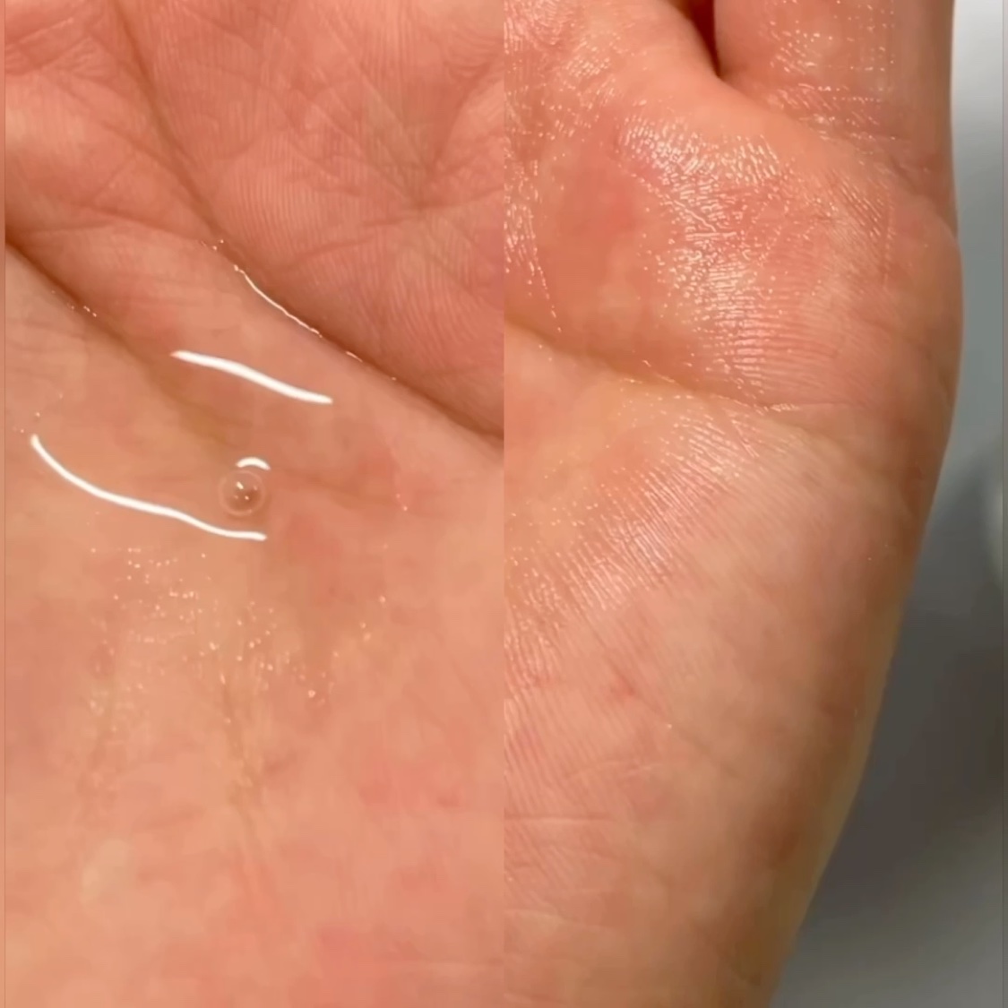 ピールケアセラム 乳酸6%/HiCA/ピーリングの動画クチコミ1つ目