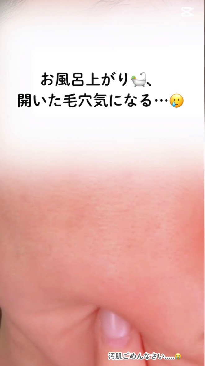 ブラックチェリー 毛穴引き締めクリーム ロフディ/ODELOI/フェイスクリームを使ったクチコミ（1枚目）