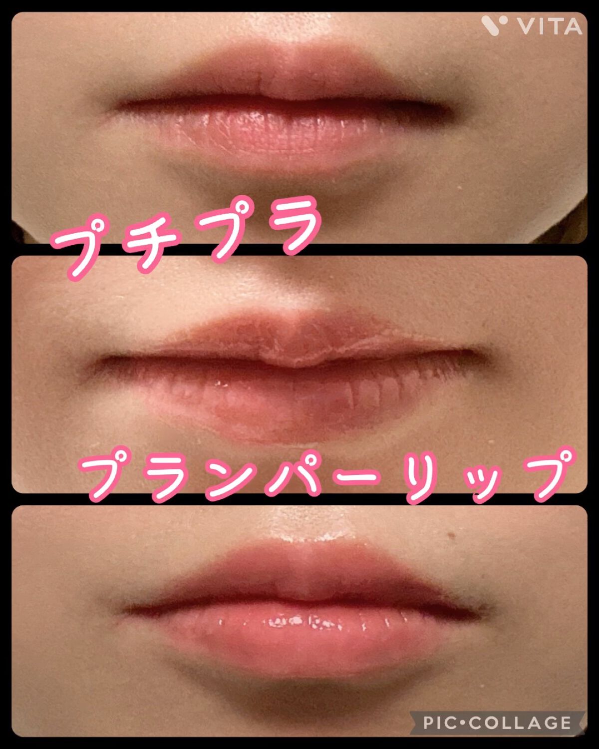 ドトムリッププラスプランパー/keybo/リッププランパーの人気ショート動画