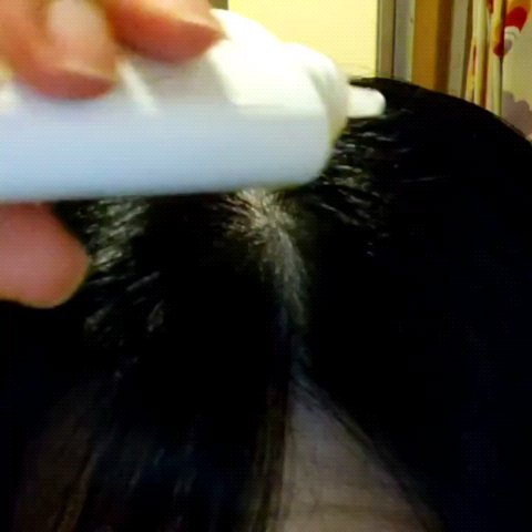 オンリーユースカルプセラム/hoLy_One/頭皮ローションを使ったクチコミ（3枚目）