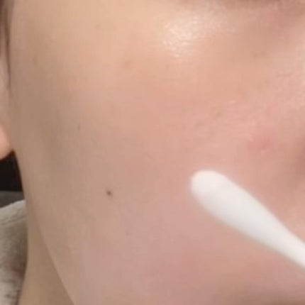 ピンクパウダースポットトリートメント/EUYIRA/その他スキンケアを使ったクチコミ(3枚目)