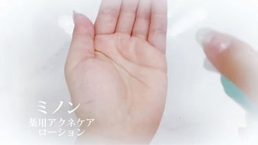 ミノン アミノモイスト 薬用アクネケア ローション/ミノン/化粧水を使ったクチコミ（2枚目）