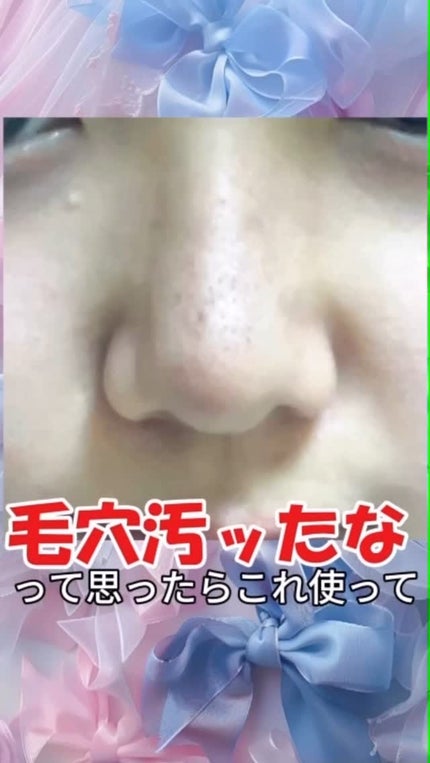 ナイアシンジンクビーズセラム/Frankly/美容液の人気ショート動画