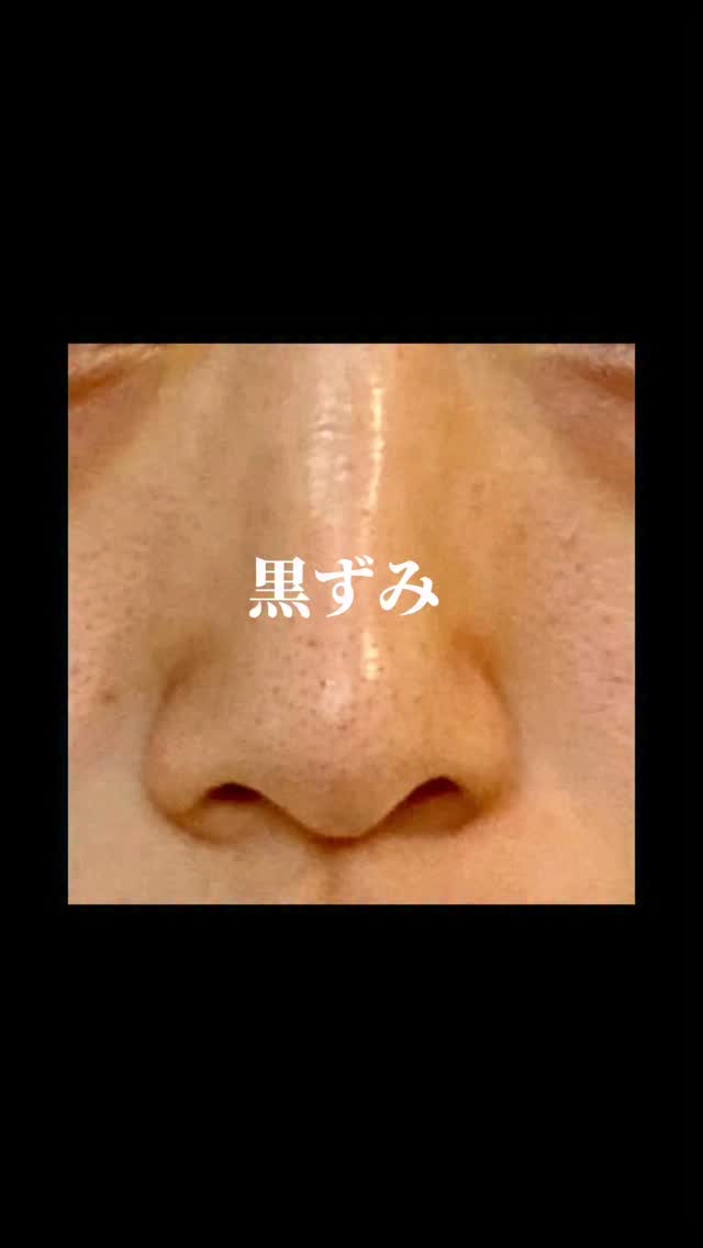 
.
.
 
こんばんは、ナラです🌙
ついに…メガ割コラボ KOPHER編、解禁です！！🔥
 
毛穴の黒ずみ、詰まり、ニキビ。
この“毛穴三銃士”に人生狂わされてきた私が1年中、本気で手放せない毛穴ケアのエース。
それがKOPHER！！