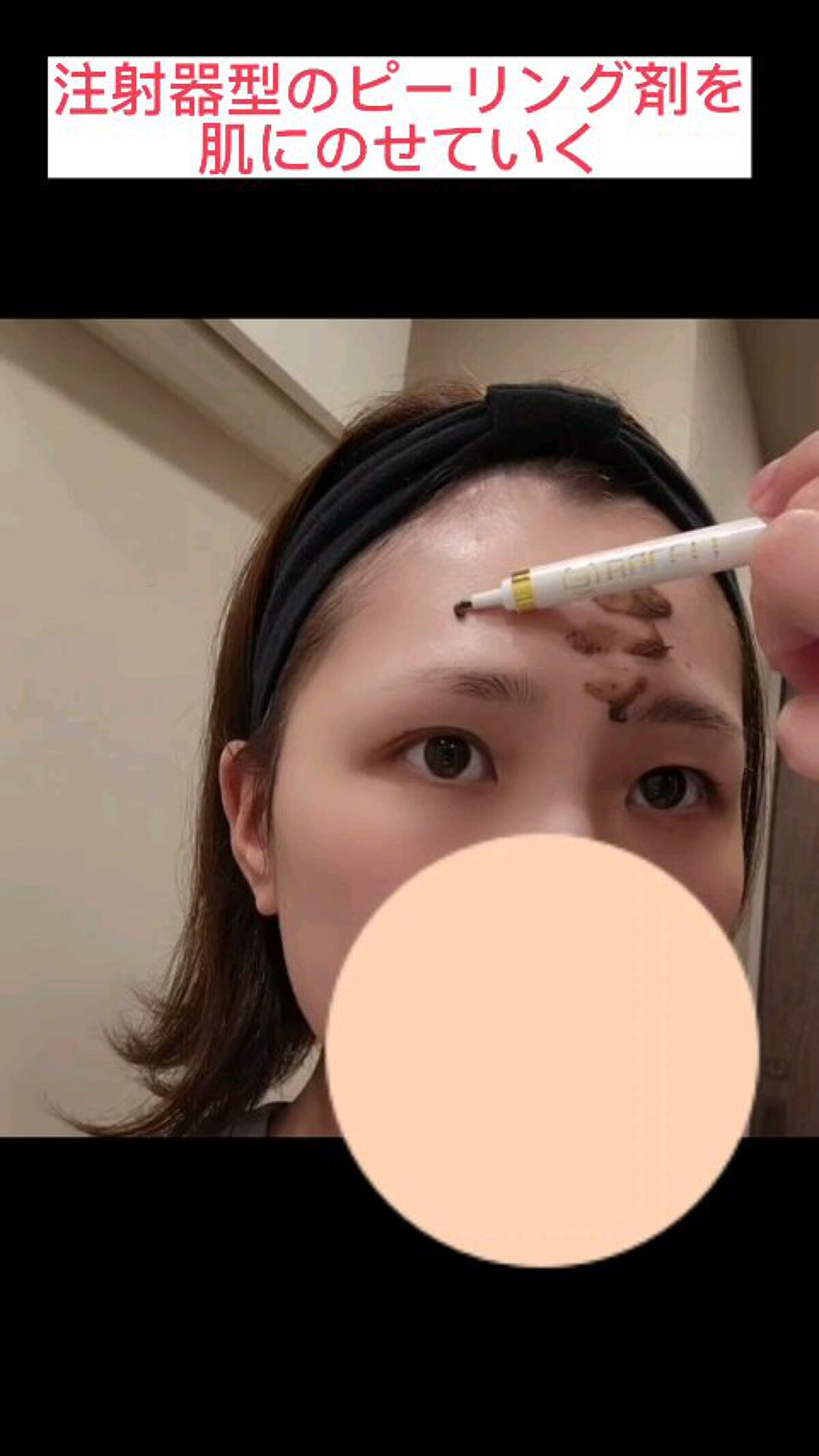 ダーマスキンピーリング/BQCELL/その他キットセットを使ったクチコミ（1枚目）