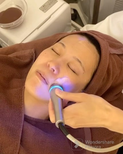 ふうせん @フォロバ100% on LIPS 「話題のLDMトリプルリフティングで肌再生してきたよ♡♡@bea..」(2枚目)