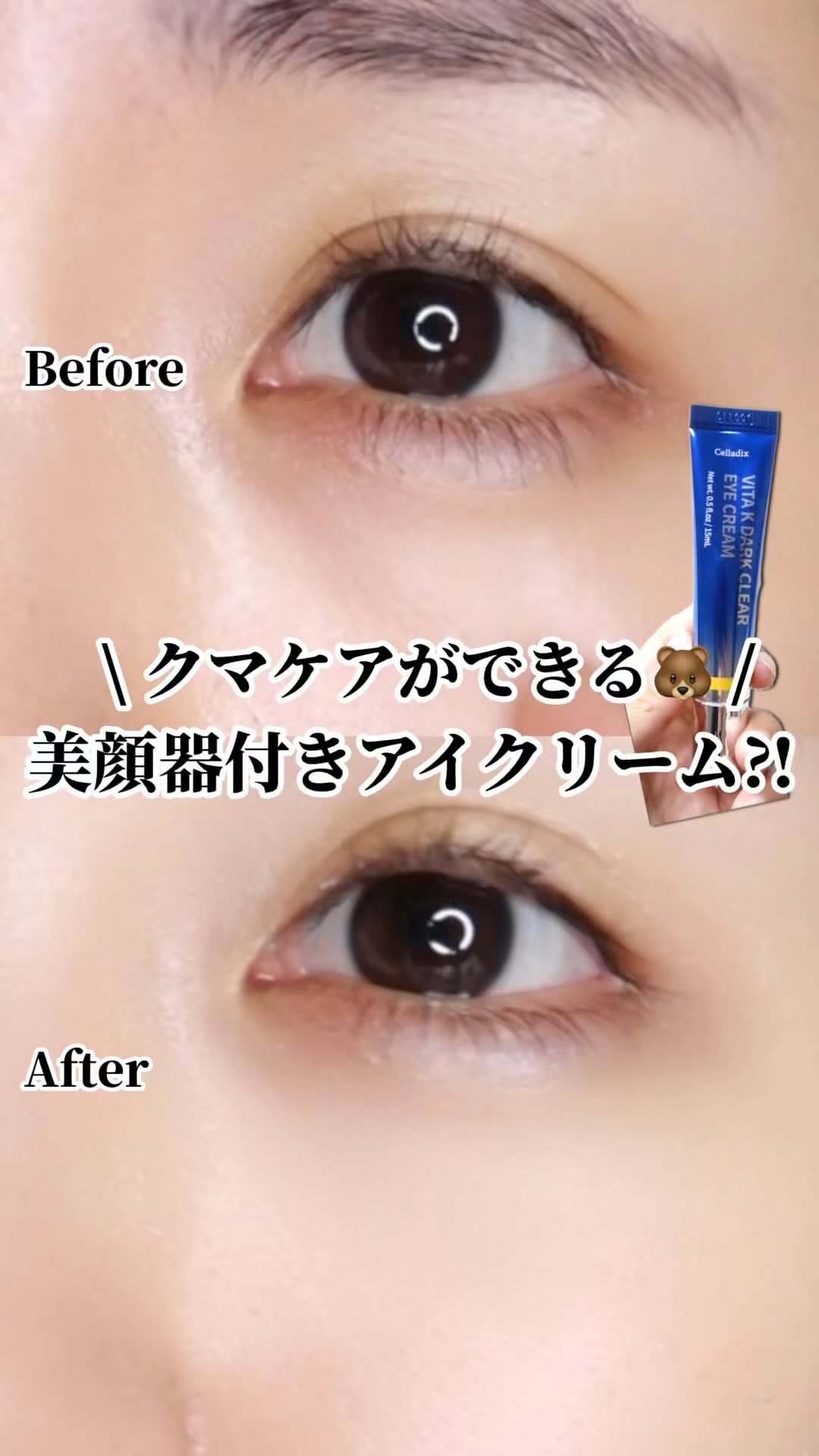 VITA K DARK CLEAR EYE CREAM/Celladix/アイケア・アイクリームを使ったクチコミ（1枚目）