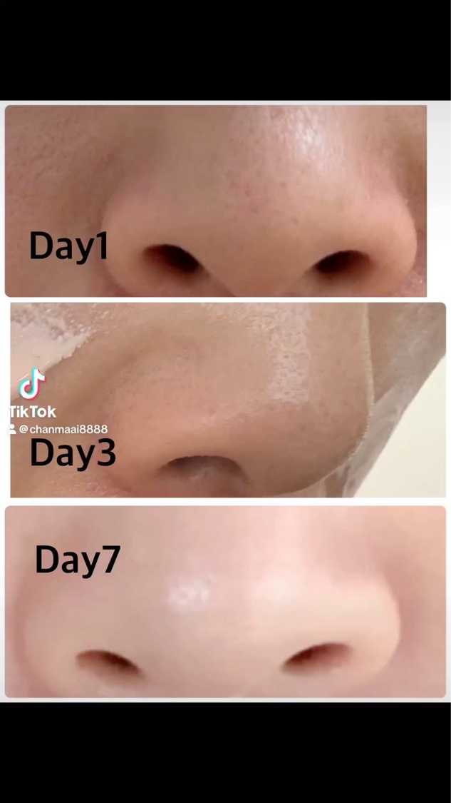 ブラックチェリー 毛穴引き締めクリーム ロフディ/ODELOI/フェイスクリームを使ったクチコミ（1枚目）