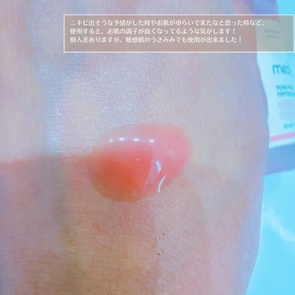 PDRNピンクアンプル PDRN 10,000ppm配合/MEDICUBE/美容液を使ったクチコミ(4枚目)