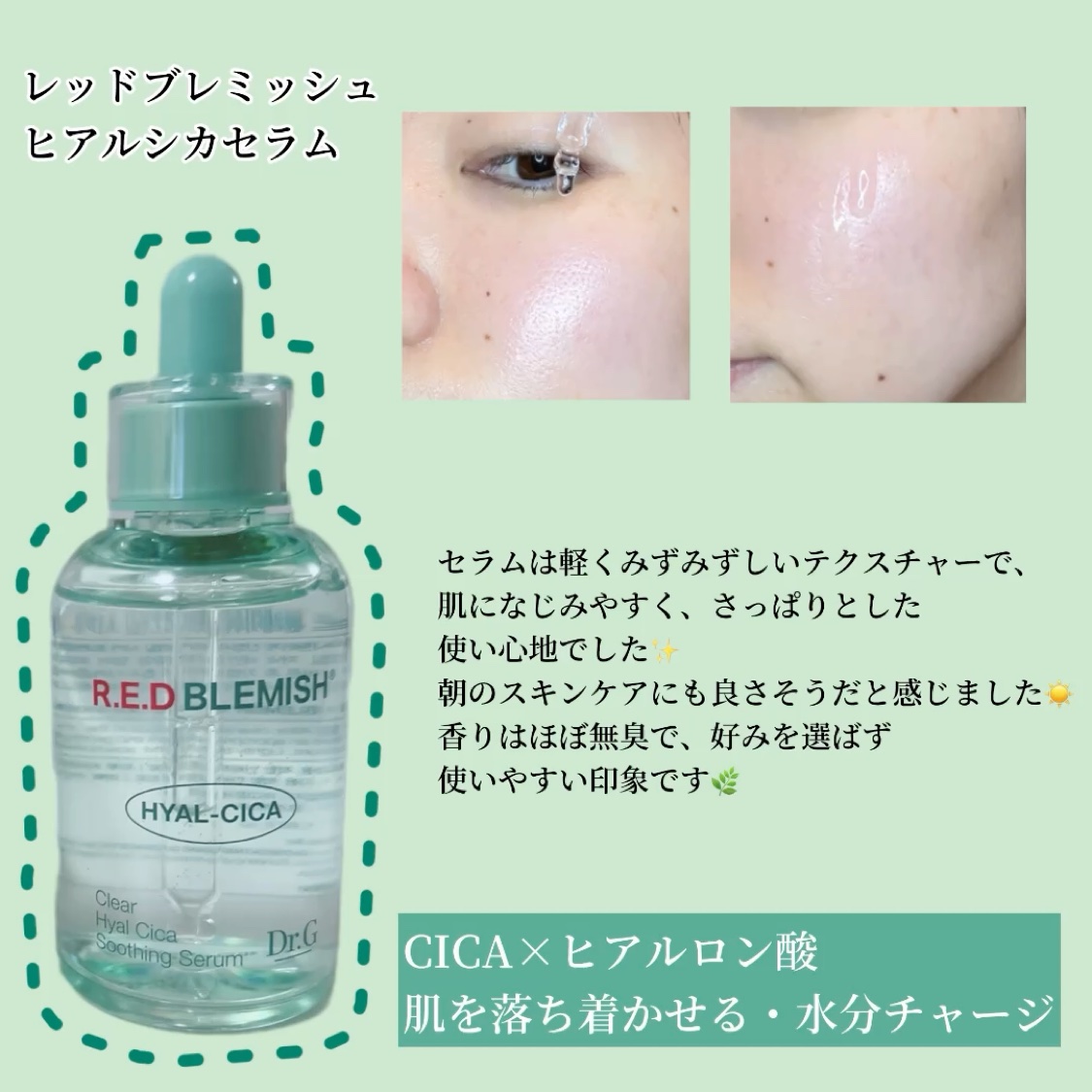 レッドブレミッシュ クリアスージングクリーム/Dr.G/フェイスクリームを使ったクチコミ（2枚目）