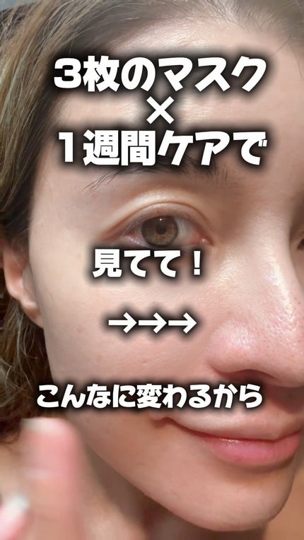 マルダ 3ステップソリューション 毛穴パック ハイドロゲルマスクパック/maldda/シートマスク・パックを使ったクチコミ(1枚目)