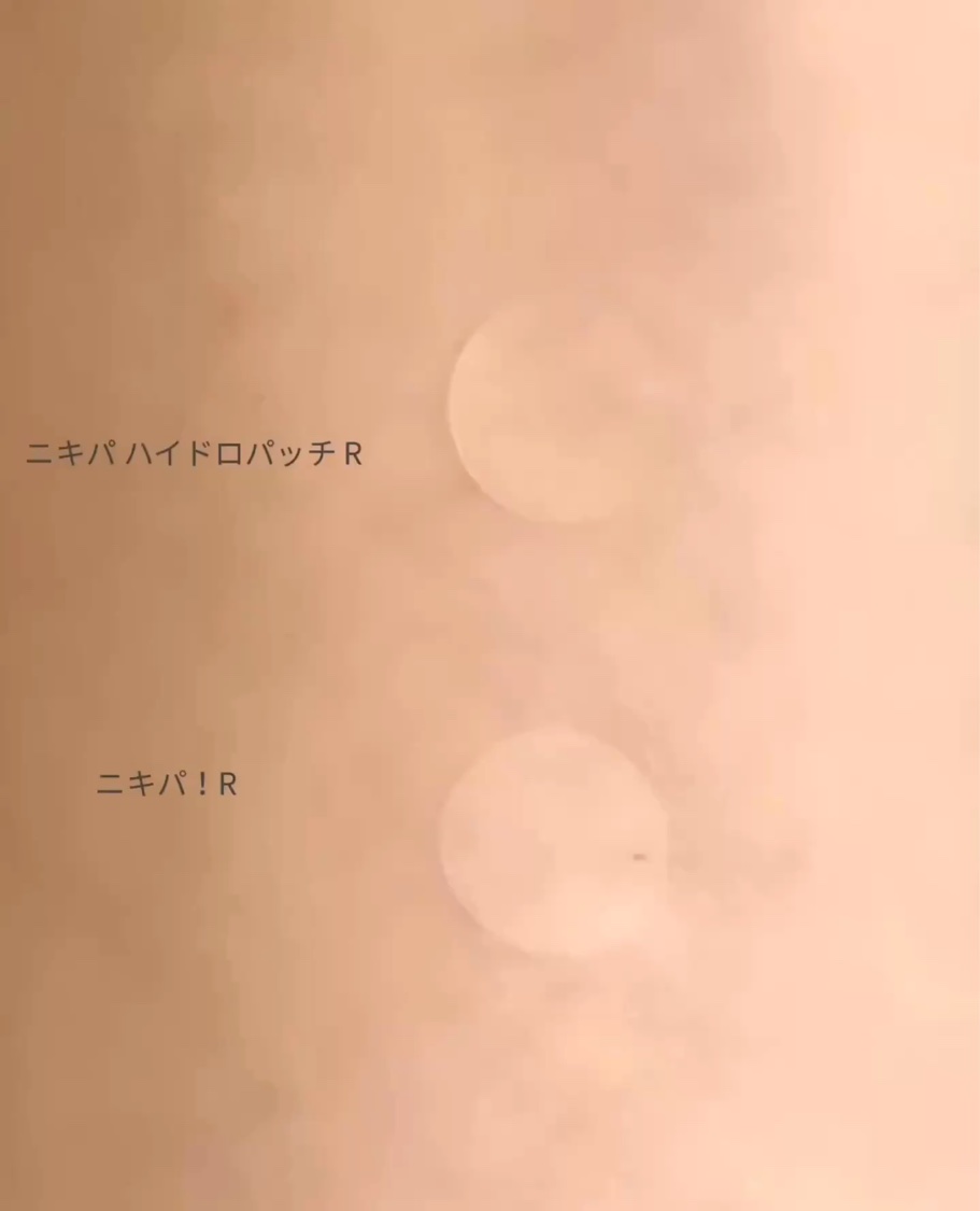  ハイドロパッチ nikipa!/金冠堂/にきびパッチの動画クチコミ1つ目