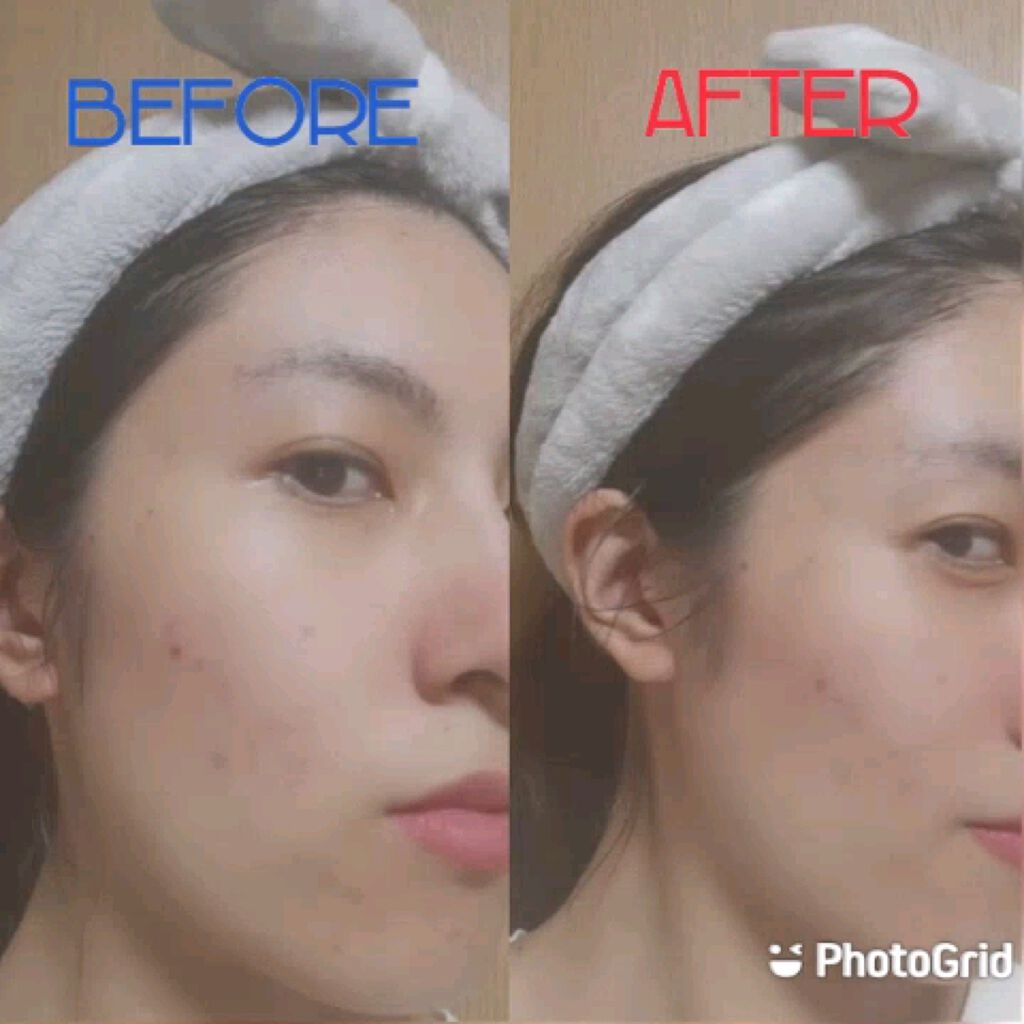 マイルド＆モイスチャーアロエジェル/ネイチャーリパブリック/ボディローションを使ったクチコミ（3枚目）