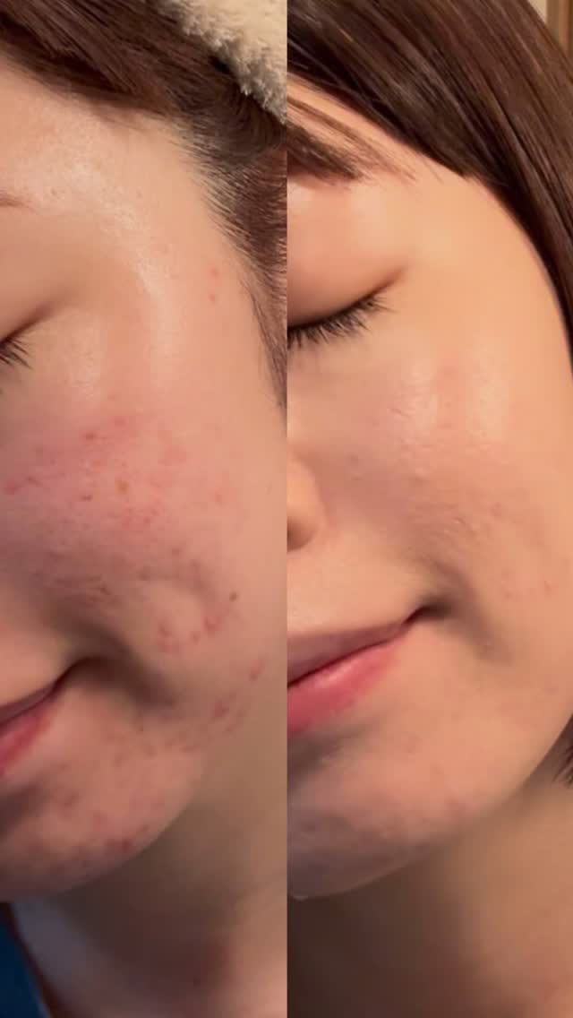 フィー クッションエッグフィットカバー/fwee/クッションファンデーションの人気ショート動画