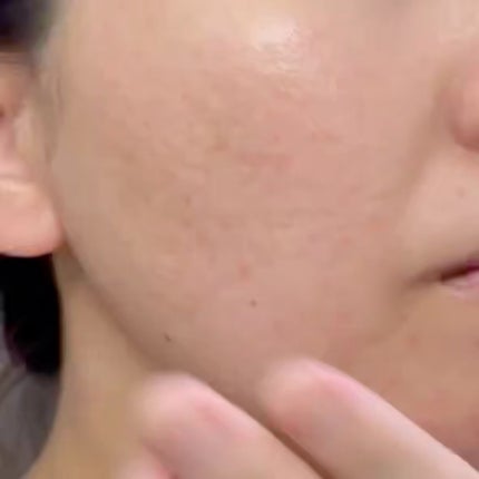 トランシーノ薬用ブライトニングクリアローション/トランシーノ/化粧水を使ったクチコミ(5枚目)