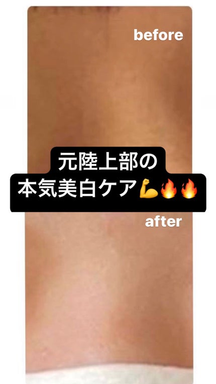 ルルルンピュア 白(クリア)/ルルルン/シートマスク・パックの人気ショート動画