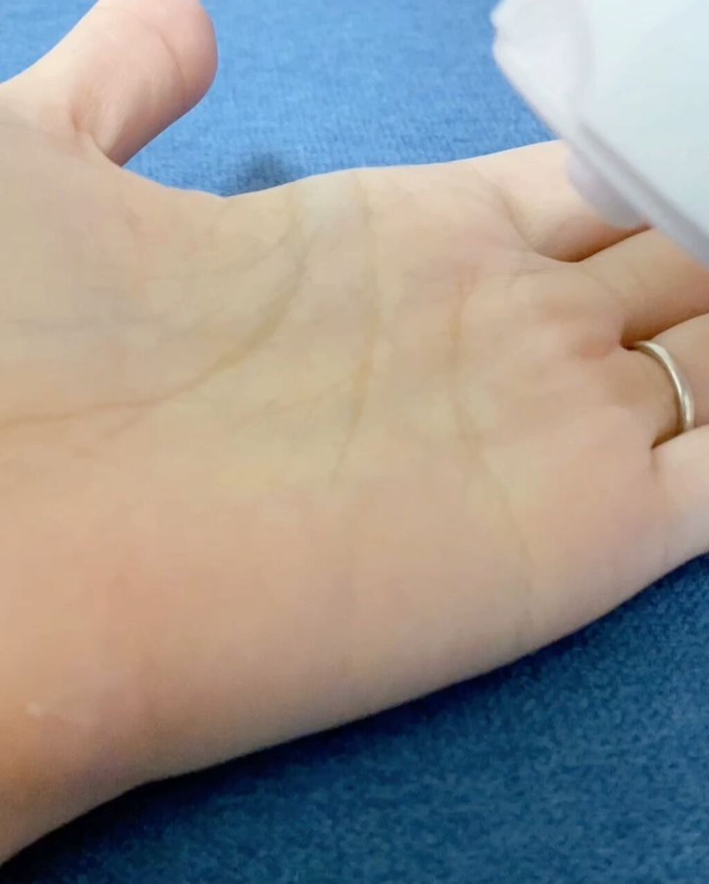 アトバリア365クリーム/AESTURA/フェイスクリームを使ったクチコミ（2枚目）