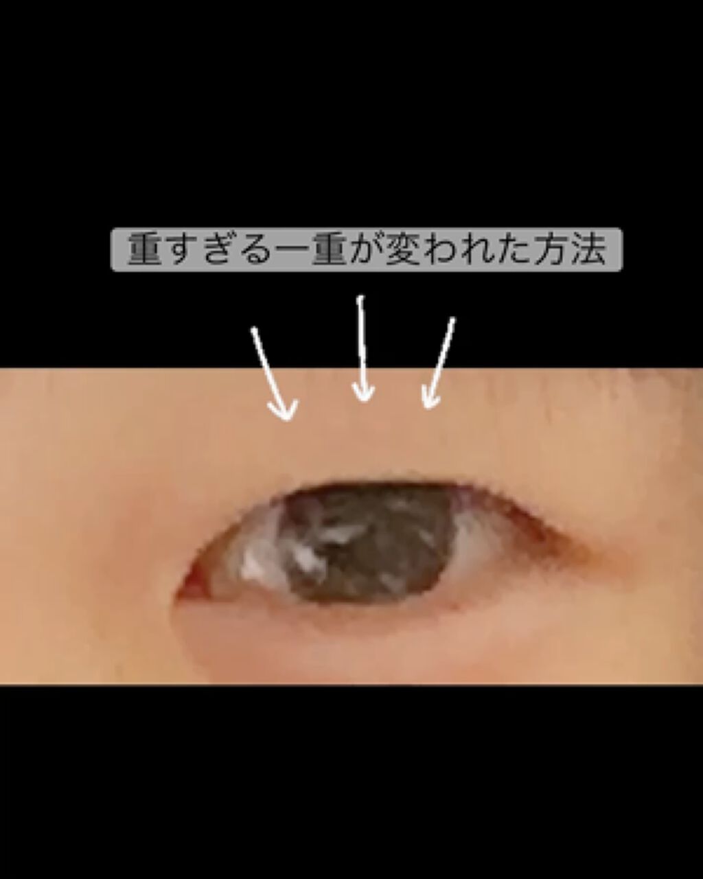 のび〜る アイテープ 両面テープタイプ/DAISO/二重まぶた用アイテムを使ったクチコミ（1枚目）