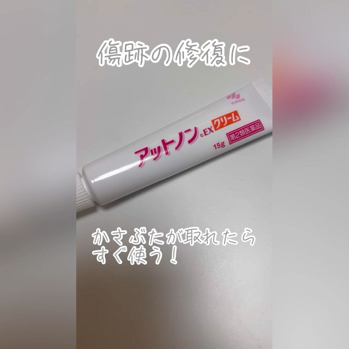 アットノンEX クリーム(医薬品)/アットノン/その他を使ったクチコミ（1枚目）