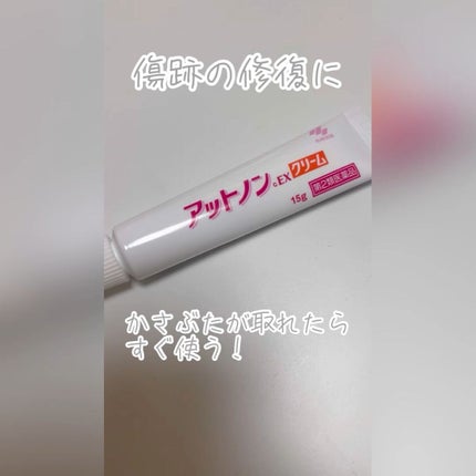 アットノンEX クリーム(医薬品)/アットノン/その他を使ったクチコミ(1枚目)