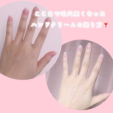 コエンリッチQ10 トーンアップ ハンドクリームのクチコミ「🤚🏻🎀毛穴ゼロで手の女子力あげませんか？🤚🏻

こんばんわ、ねころびです☁　　☁　　

先月、.....」（2枚目）