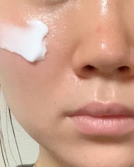 ドクダミ 70 インテンスカーミングクリーム/Anua/フェイスクリームを使ったクチコミ(5枚目)