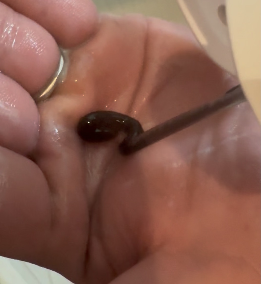 薬用さらさらクリーム/デオナチュレ/デオドラント・制汗剤を使ったクチコミ（2枚目）