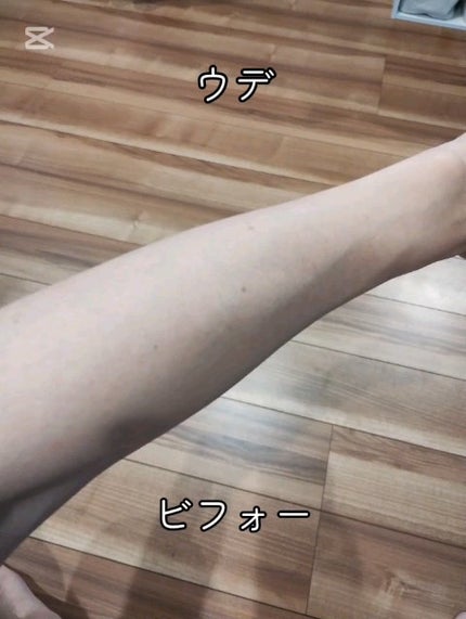 光美容器KE-NON(ケノン)/エムテック/家庭用脱毛器を使ったクチコミ(2枚目)