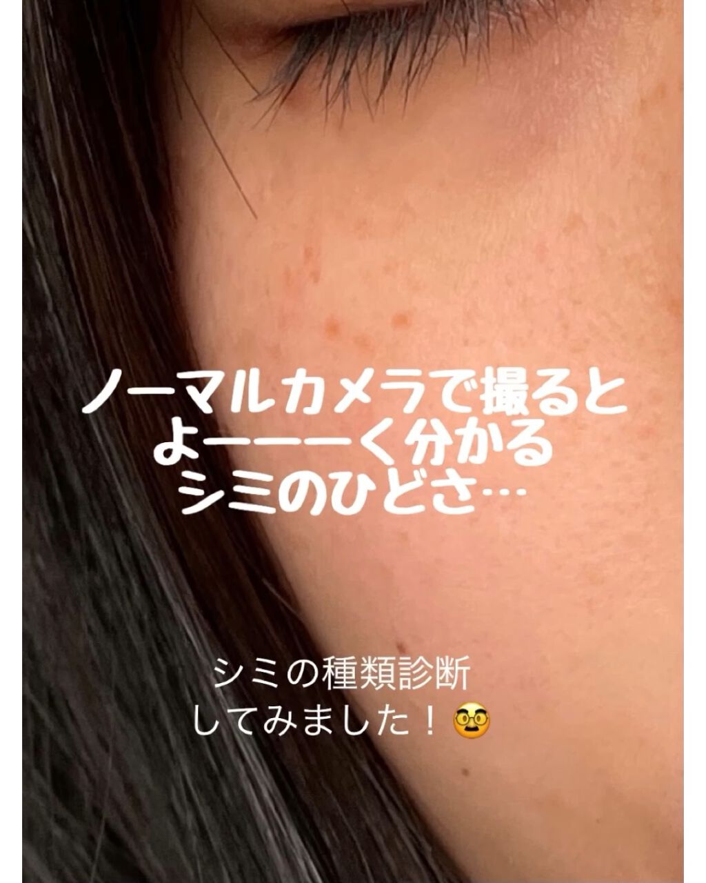 ハイチオールC（医薬品）/エスエス製薬/その他を使ったクチコミ（1枚目）