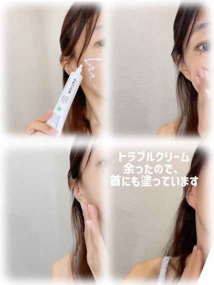 ノスカナイン トラブル セラム/FATION/美容液を使ったクチコミ(3枚目)