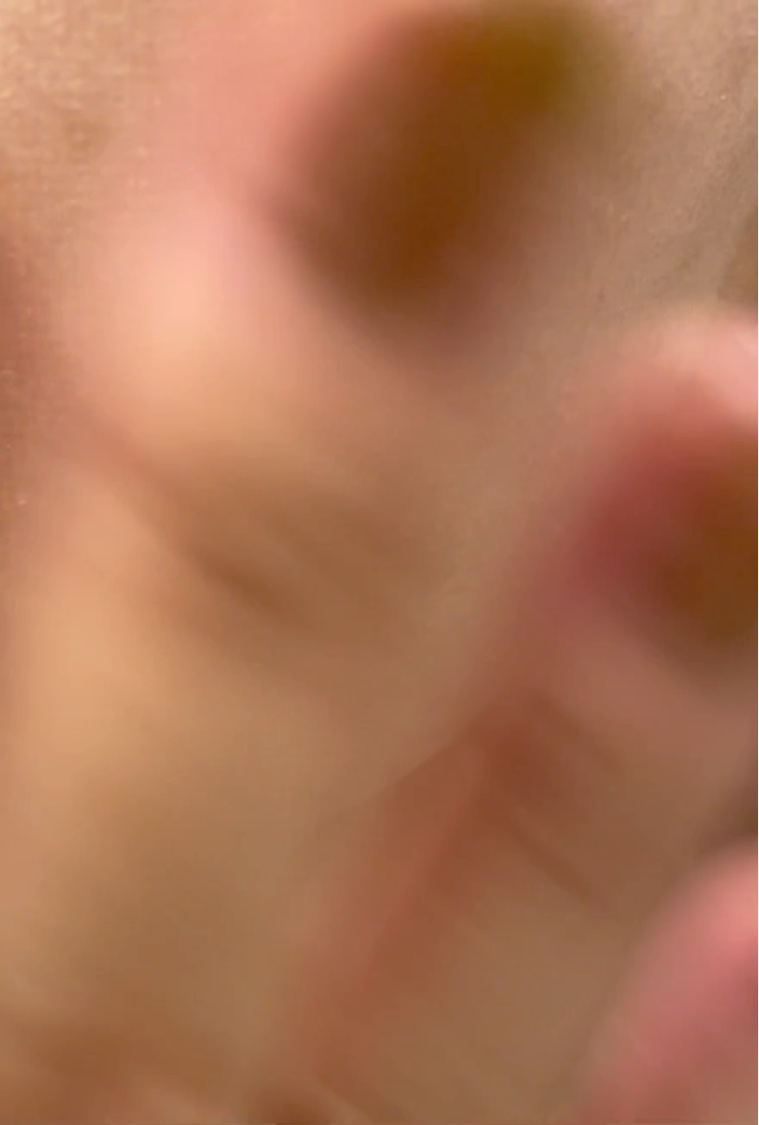 ダーマレーザー スーパーTEATREE100マスク/クオリティファースト/シートマスク・パックを使ったクチコミ（3枚目）