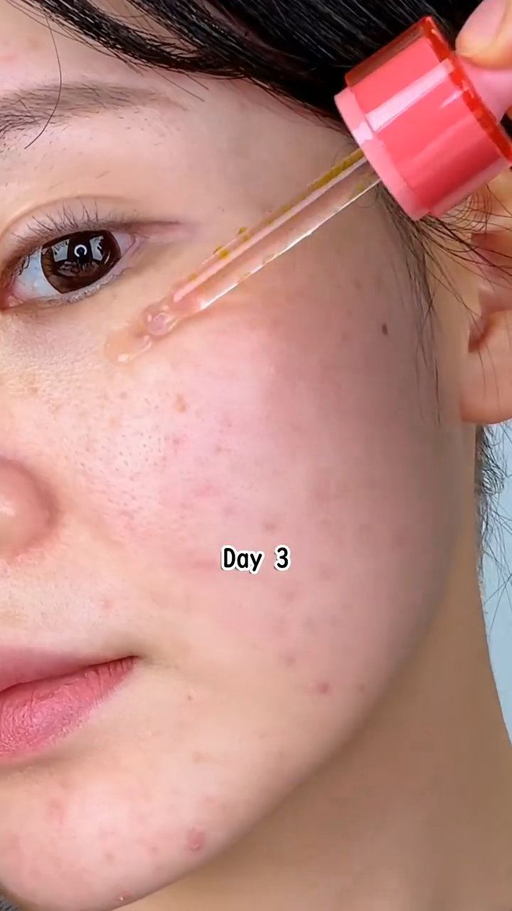 purito ナイアシンアミド１０レチナールセラム/Purito Seoul/美容液を使ったクチコミ（1枚目）