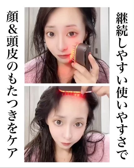 試してみた】スカルプ電気ブラシ アンファー(スカルプD)のリアル 試してみた】スカルプ電気ブラシ アンファー(スカルプD)のリアル