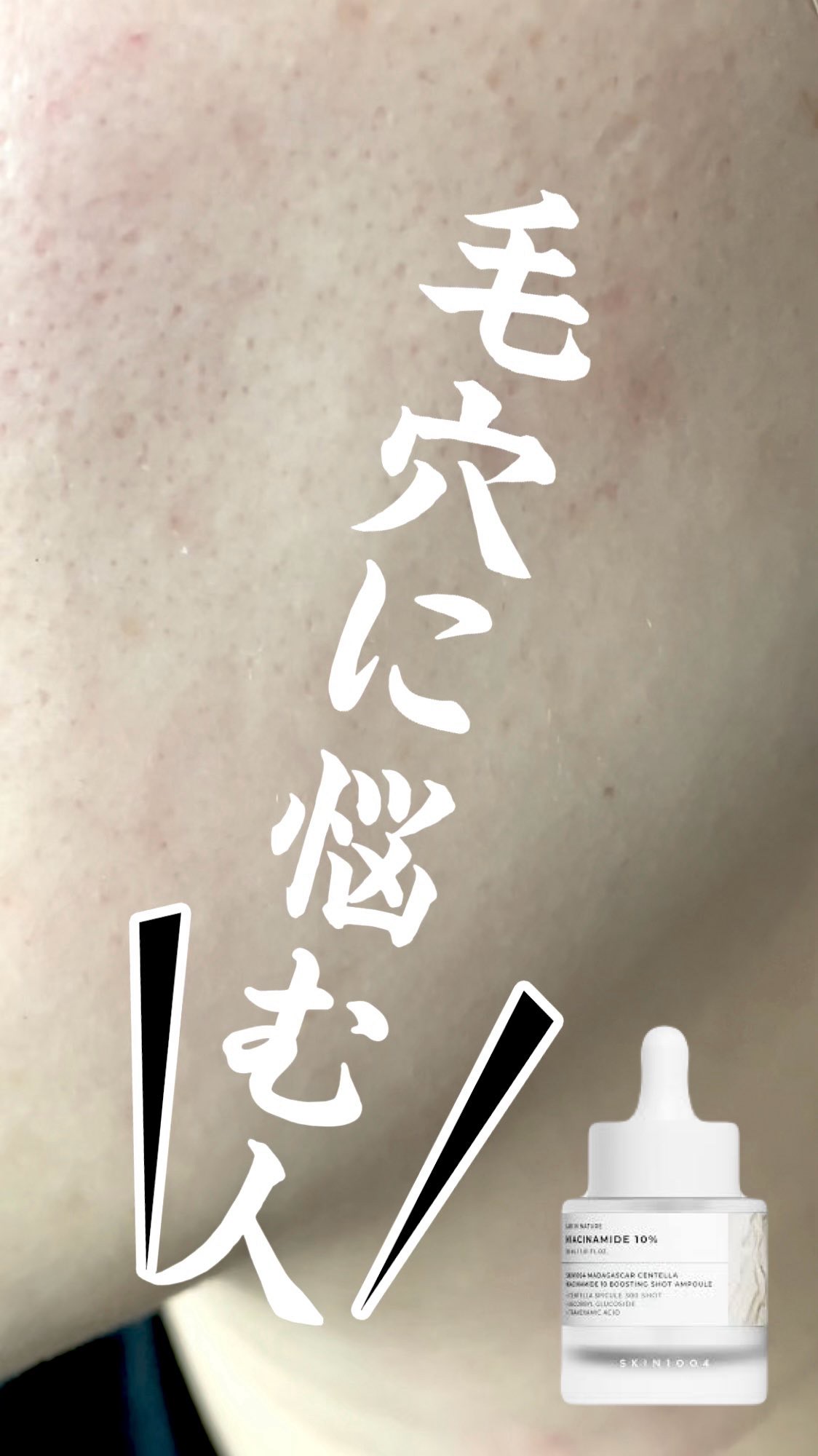 ナイアシンアミド 10 ブースティングショット アンプル/SKIN1004/美容液を使ったクチコミ（1枚目）