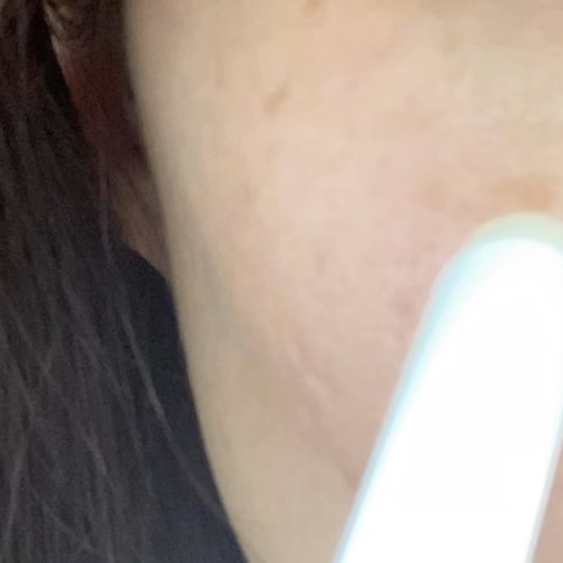 薬用ホワイトニングリフトケアスーパーCスティック/シミウス/その他スキンケアを使ったクチコミ（3枚目）