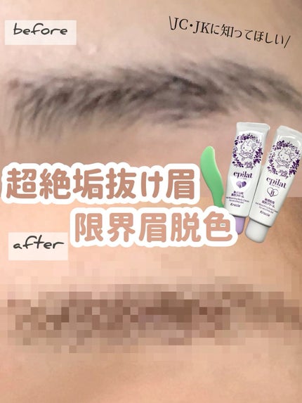 脱色クリーム 敏感肌用/エピラット/ムダ毛ケアを使ったクチコミ(1枚目)