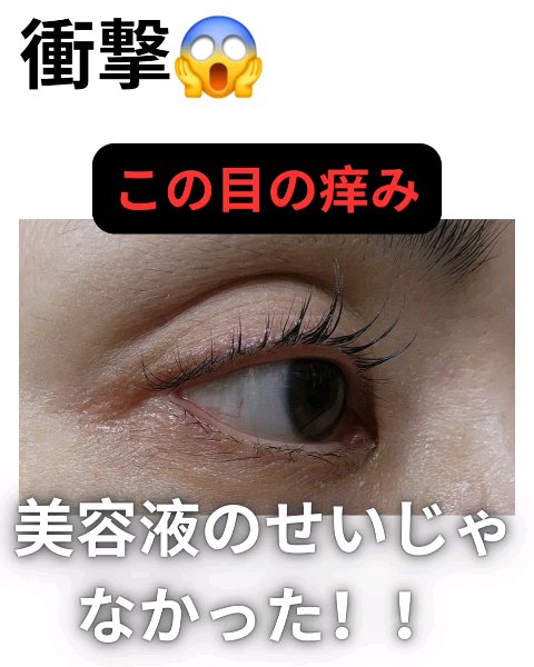 アイシャンプー/メディプロダクト/その他洗顔料の動画クチコミ2つ目