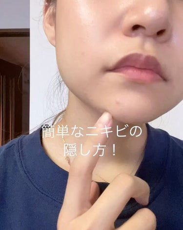 marie___1104 on LIPS 「【失敗しない‼️超簡単ニキビのかくし方！】まだまだマスクの生活..」（2枚目）