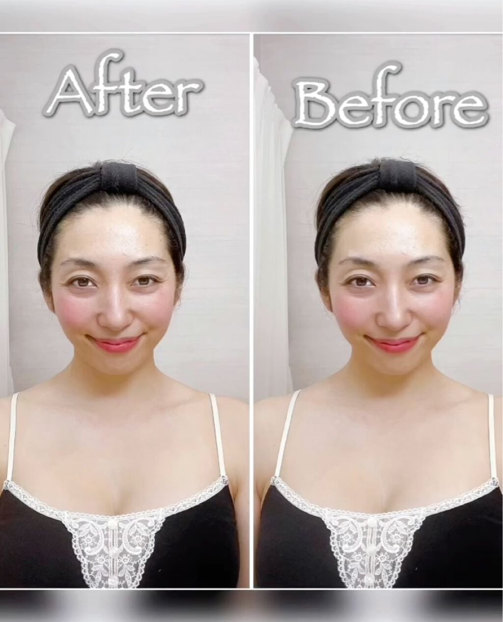 NITENA/LOABI/美顔器・マッサージを使ったクチコミ（3枚目）