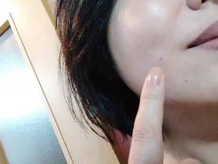 AZ アゼフィットスポッツ/NIKI PITA/フェイスクリームを使ったクチコミ(7枚目)