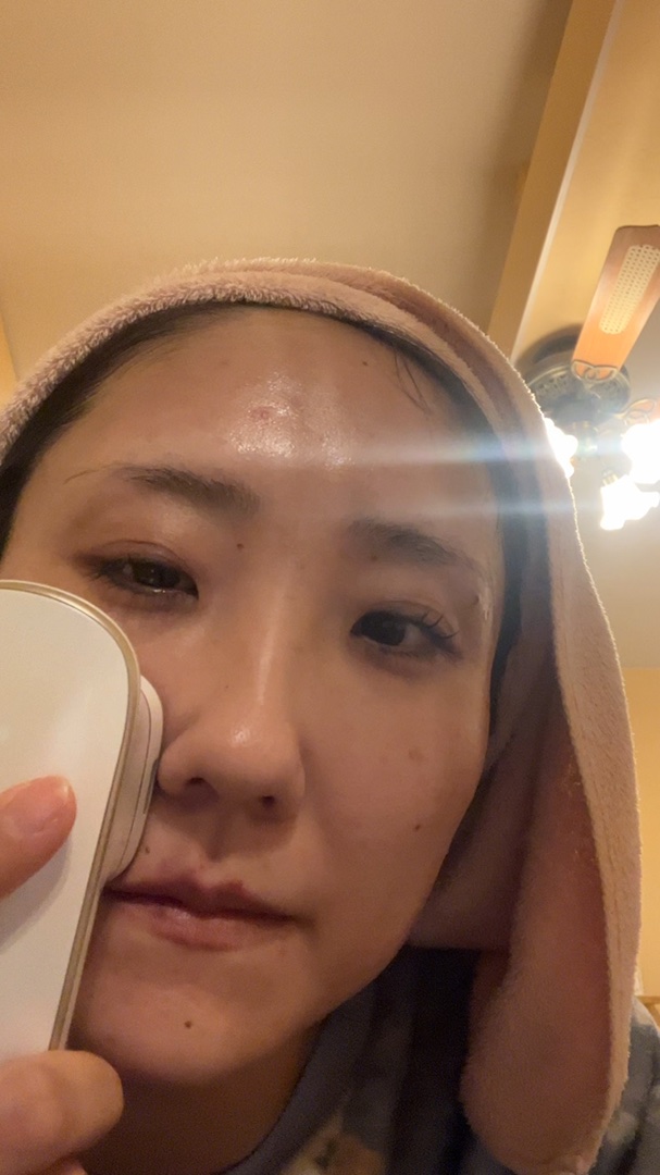 LifTone/アーリーバード/美顔器・マッサージを使ったクチコミ（1枚目）