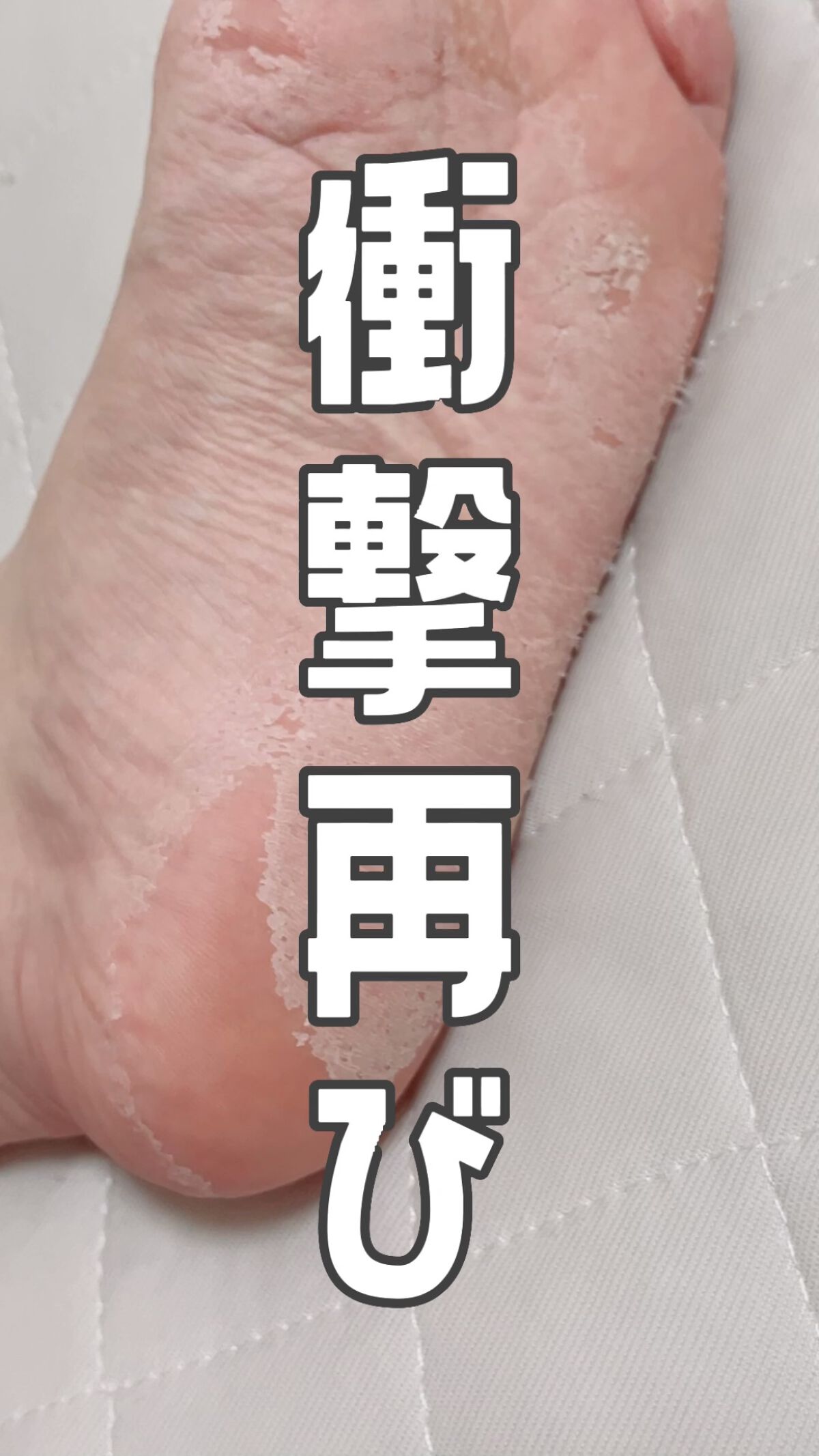 イージーパックDP60分タイプ/ベビーフット/レッグ・フットケアを使ったクチコミ（1枚目）