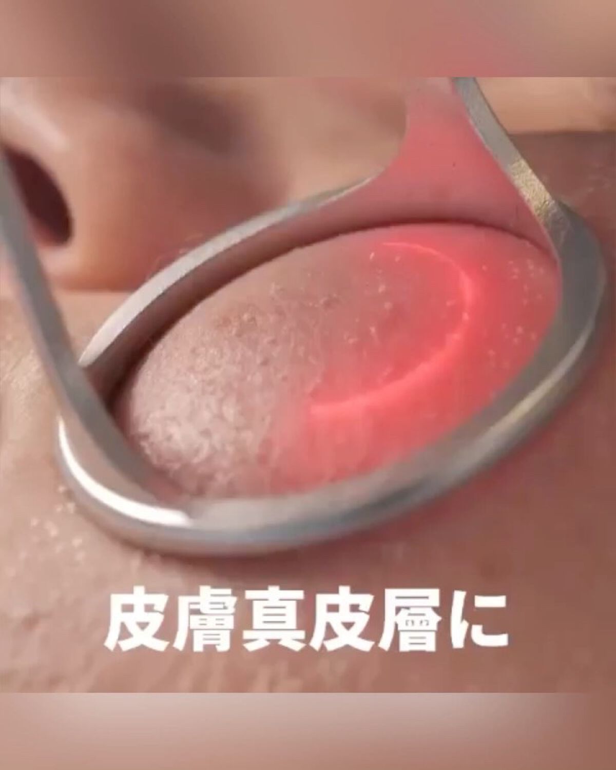 BP角質ケアトナーパッド/Dr.Melaxin/トナーパッドの動画クチコミ5つ目