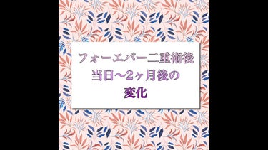 二重整形/その他を使ったクチコミ（1枚目）