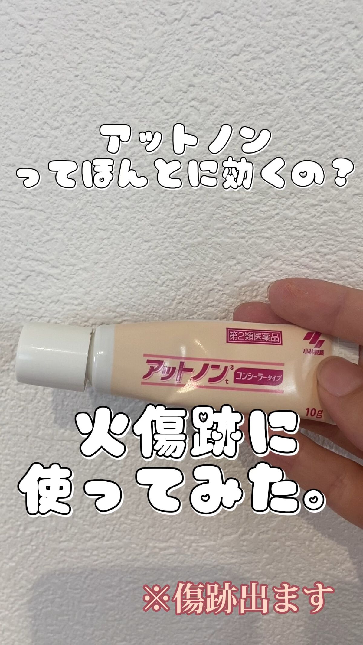 アットノン コンシーラータイプ(医薬品)/アットノン/その他を使ったクチコミ（1枚目）