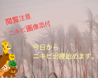 こんにちは！
一度治ったはずのニキビが大量に
発生してしまったので、今日から治療日記
始めたいと思います。

なかなか、薬の効果自体も持続しない気が
していて、治療を投げ出したくなります😐

もちろん、