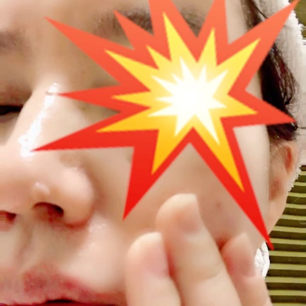 メディリフト ニードルリフトクリーム/YA-MAN TOKYO JAPAN/フェイスクリームを使ったクチコミ（3枚目）