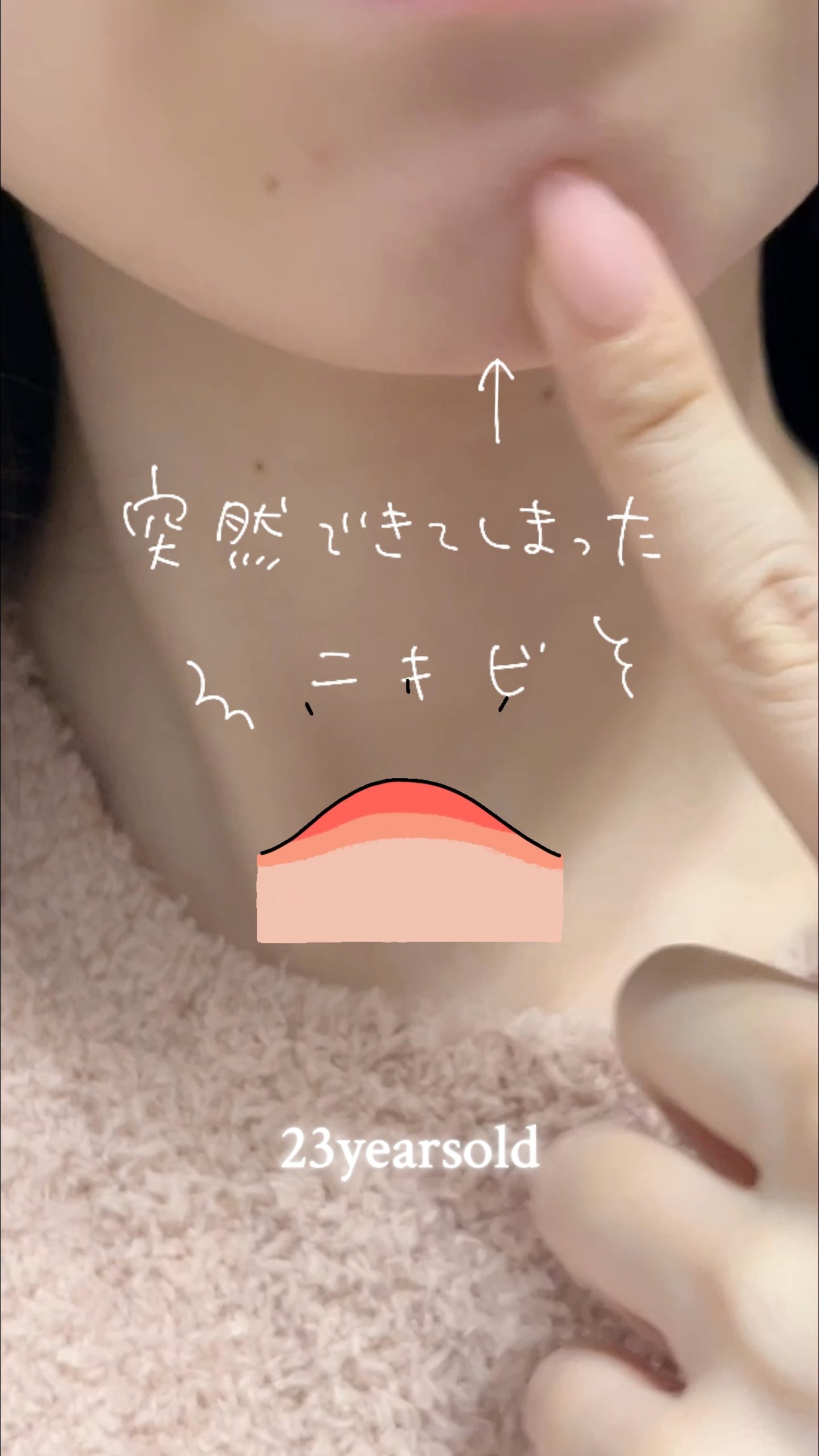 気になる肌トラブルに2種のクリーム💜💚
⌒¨⌒¨⌒¨⌒¨⌒¨⌒¨⌒¨⌒¨⌒¨⌒¨⌒¨⌒¨⌒¨⌒
23yearsold 
BADECASIL CREAM
P / D   50g

⌒¨⌒¨⌒¨⌒¨⌒¨⌒¨⌒¨⌒¨⌒¨⌒¨⌒¨⌒¨⌒¨⌒
\