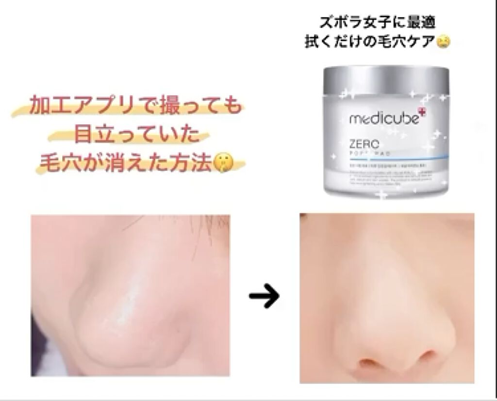 ゼロ毛穴パッド/MEDICUBE/ブースター・導入液を使ったクチコミ（1枚目）
