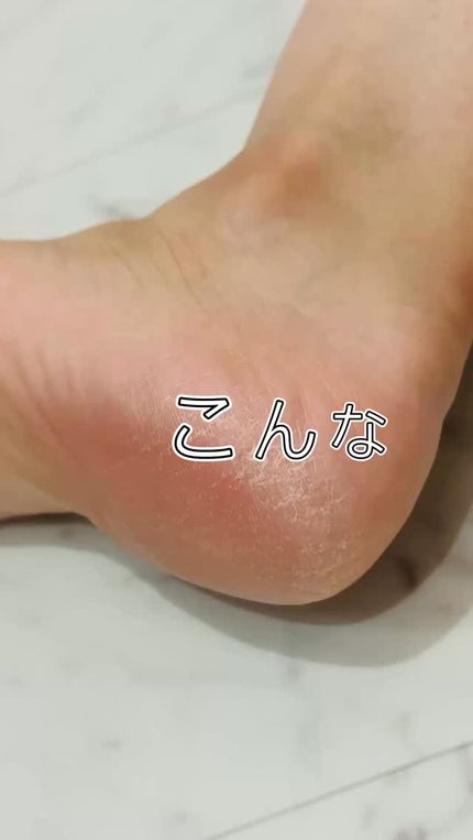 あかすりグローブ(ボディ用)/BeauRevo/バスグッズを使ったクチコミ(1枚目)